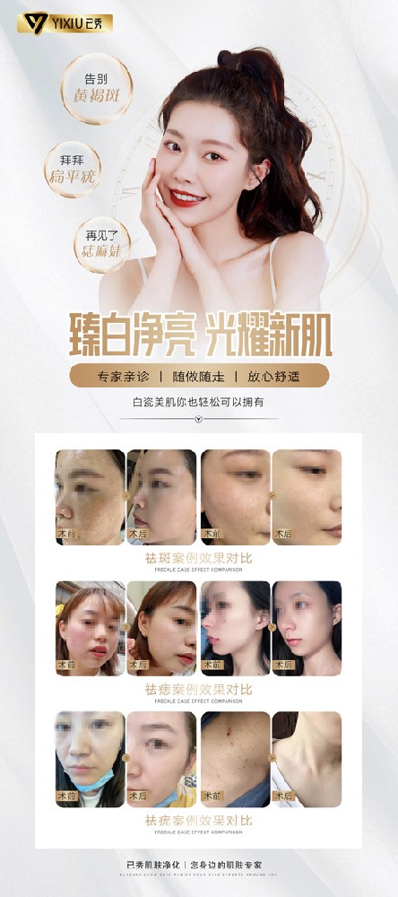 附近哪有已秀瘦身店 绍兴减肥加盟店